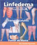 Linfedema vignette